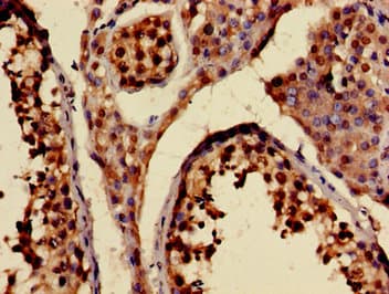RAB6KIFL / KIF20A Antibody