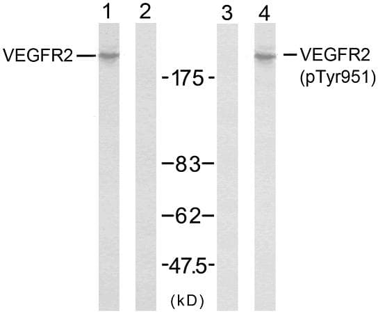 KDR / VEGFR2 / FLK1 Antibody (phospho-Tyr951)