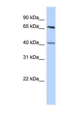 RBBP5 Antibody (aa431-480)