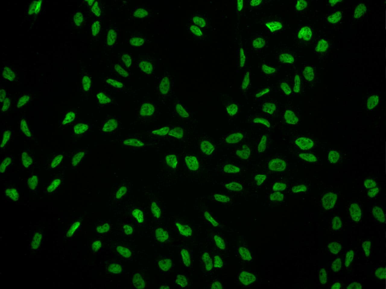 Polyclonal Rabbit anti-Human SCAF8 Antibody (IHC, IF)