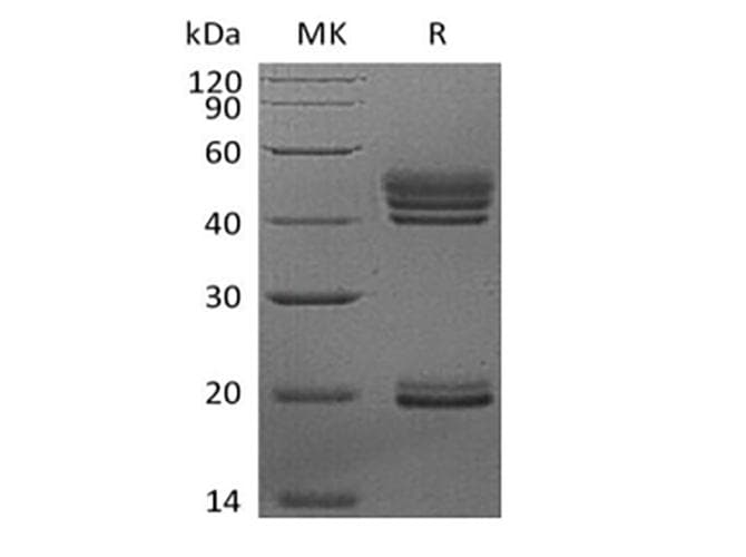Human IL23A / IL-23 p19 Protein (Recombinant 6His, C-terminus)