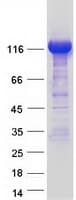 Human LPIN1 / Lipin 1 Protein (Recombinant Myc-DDK (Flag))