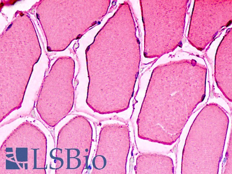 PathPlus™ Monoclonal Mouse anti-Human MB / Myoglobin Antibody (clone AT6E10, IHC, WB)