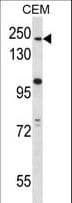 Polyclonal Rabbit anti-Human ATG2B Antibody (aa118-146, WB)