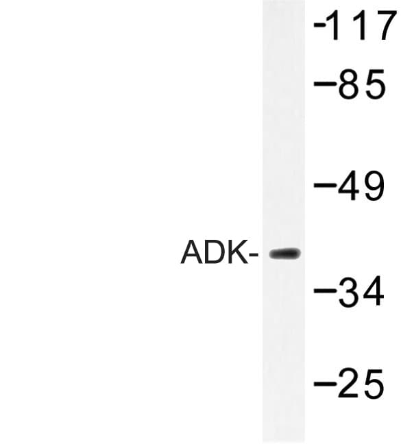 Polyclonal Rabbit anti-Human Adenylate Kinase Antibody (Glu6, IF, WB)