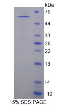 Human NXPH1 Protein (Recombinant His-GST)