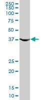 Monoclonal Mouse anti-Human PGK1 / Phosphoglycerate Kinase Antibody (clone 2H4, WB)