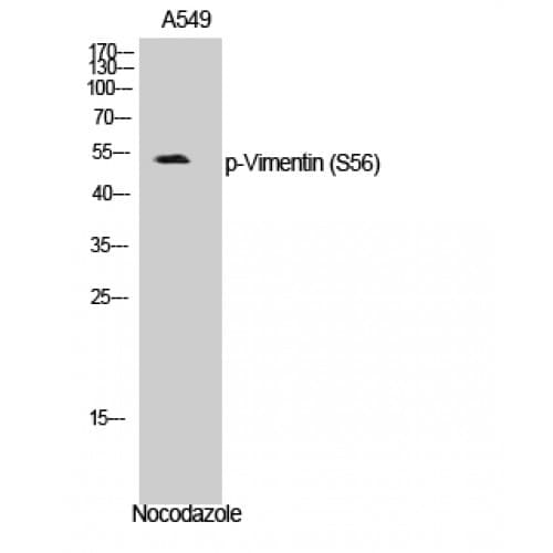 Vimentin Antibody (1-80 aa)