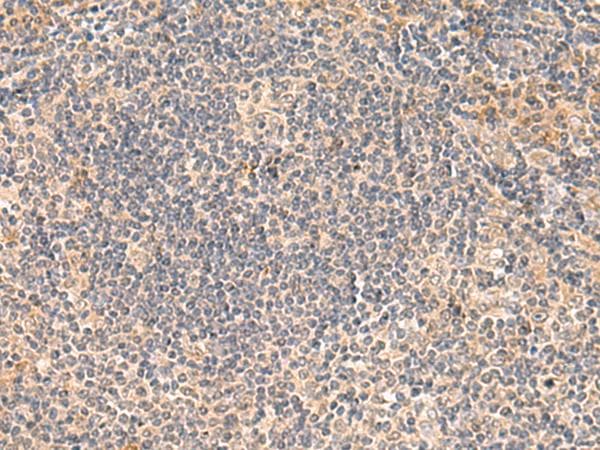 FUNDC2 Antibody