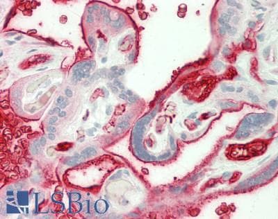 IHC-plus™ APOB / Apolipoprotein B Antibody