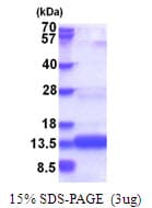 Human CHCHD8 Protein (Recombinant His)