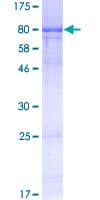 Human RCOR1 / COREST Protein (Recombinant GST)