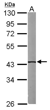 Polyclonal Rabbit anti-Human IVD Antibody (aa1-222, IHC, WB)