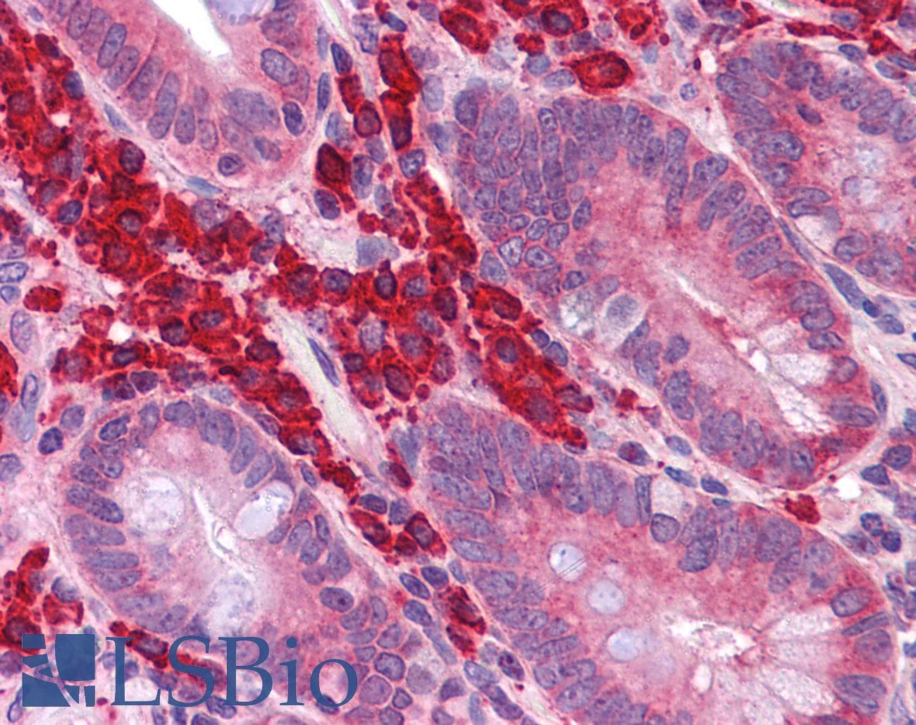 IHC-plus™ FOXO4 / AFX1 Antibody