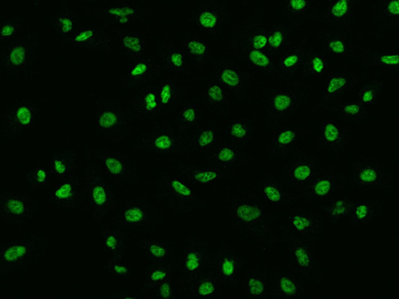 SBNO1 Antibody