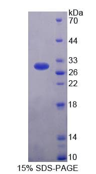 Chicken GSTA3 Protein (Recombinant His-T7)