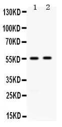 ALDH3A2 Antibody