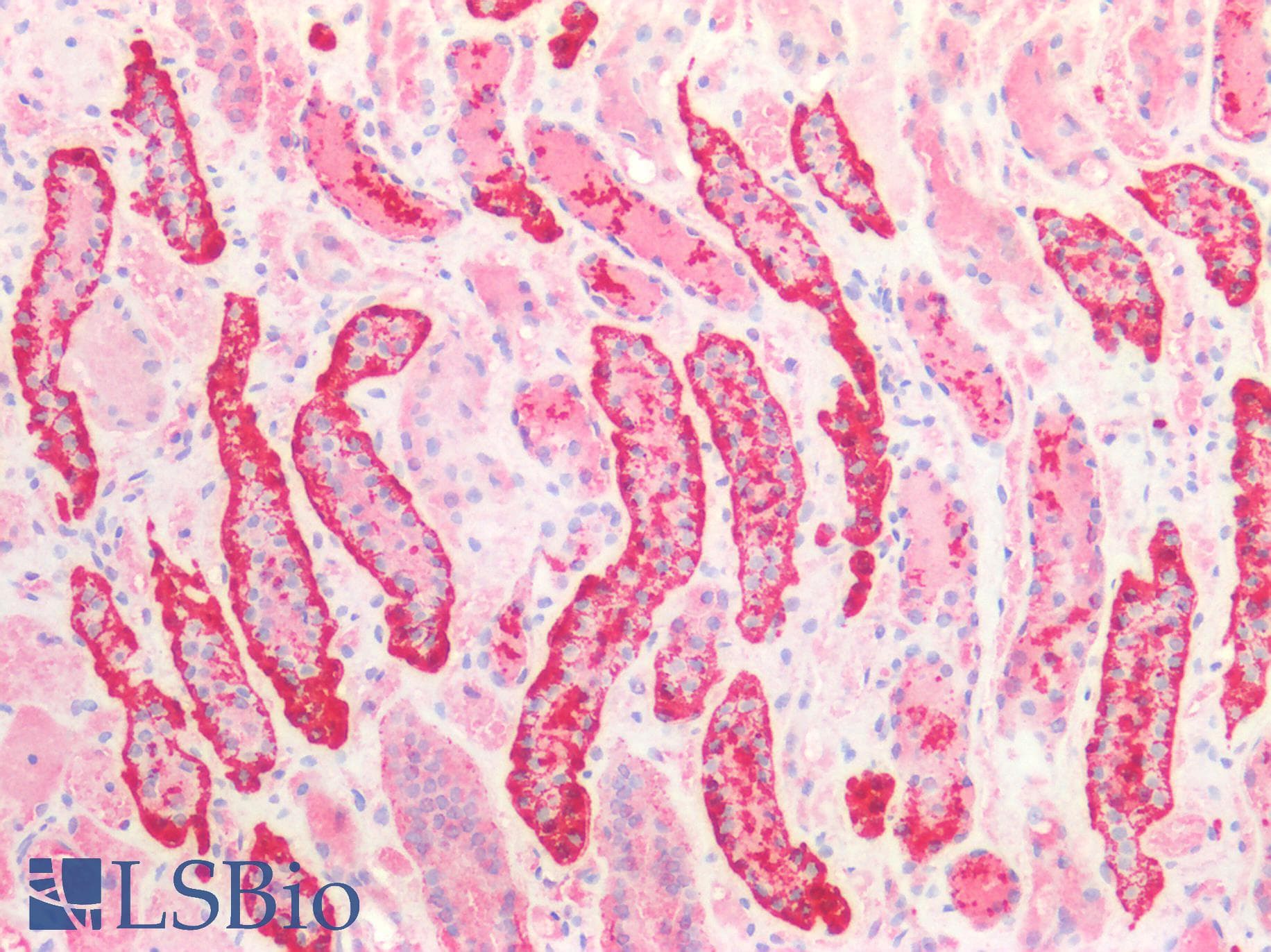 PathPlus™ CDH16 / Cadherin 16 Antibody (aa19-230)