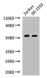 Polyclonal Rabbit anti-Human TGFBR1 / ALK5 Antibody (IHC, IF, WB)