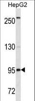 Monoclonal Mouse anti-Human CD19 Antibody (clone 400CT14.1.4, aa505-532, WB)
