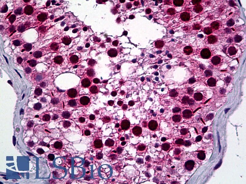 IHC-plus™ NEK2 Antibody (clone 2F6)