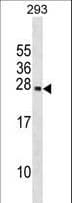 Polyclonal Rabbit anti-Human PRL / Prolactin Antibody (aa48-76, WB)