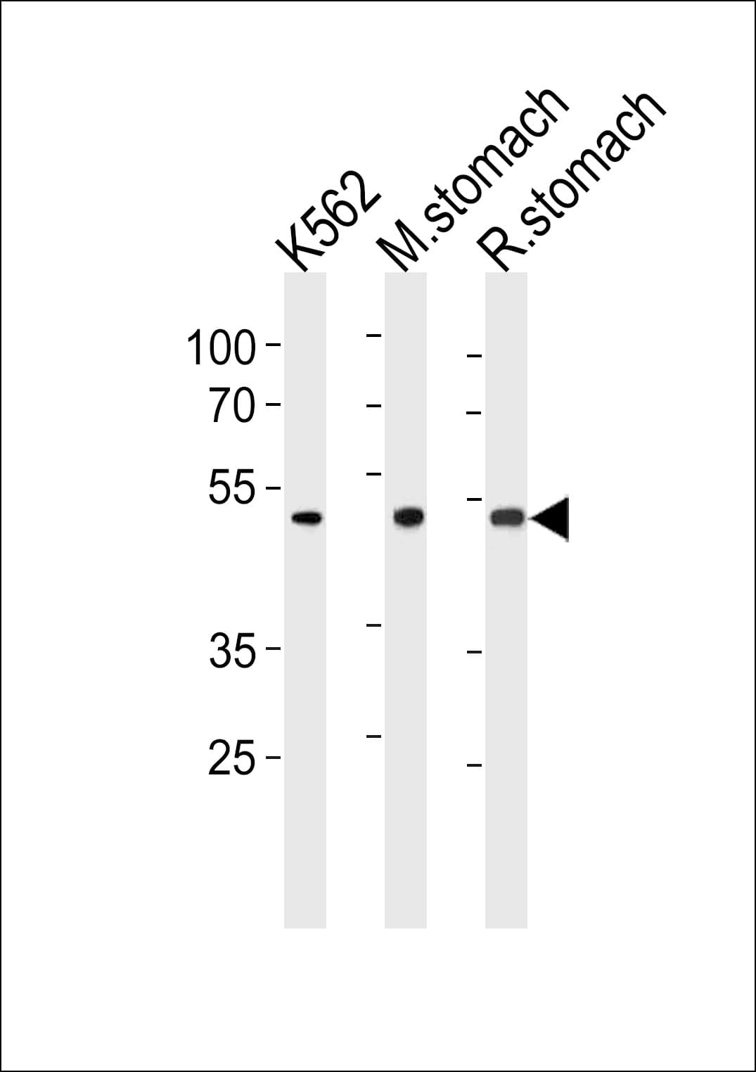 BLMH Antibody (aa212-242)
