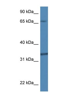 TBCB / CKAP1 Antibody (aa37-86)