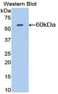NT5E / eNT / CD73 Antibody (aa29-550)