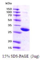 Human YWHAZ / 14-3-3 Zeta Protein (Recombinant His)