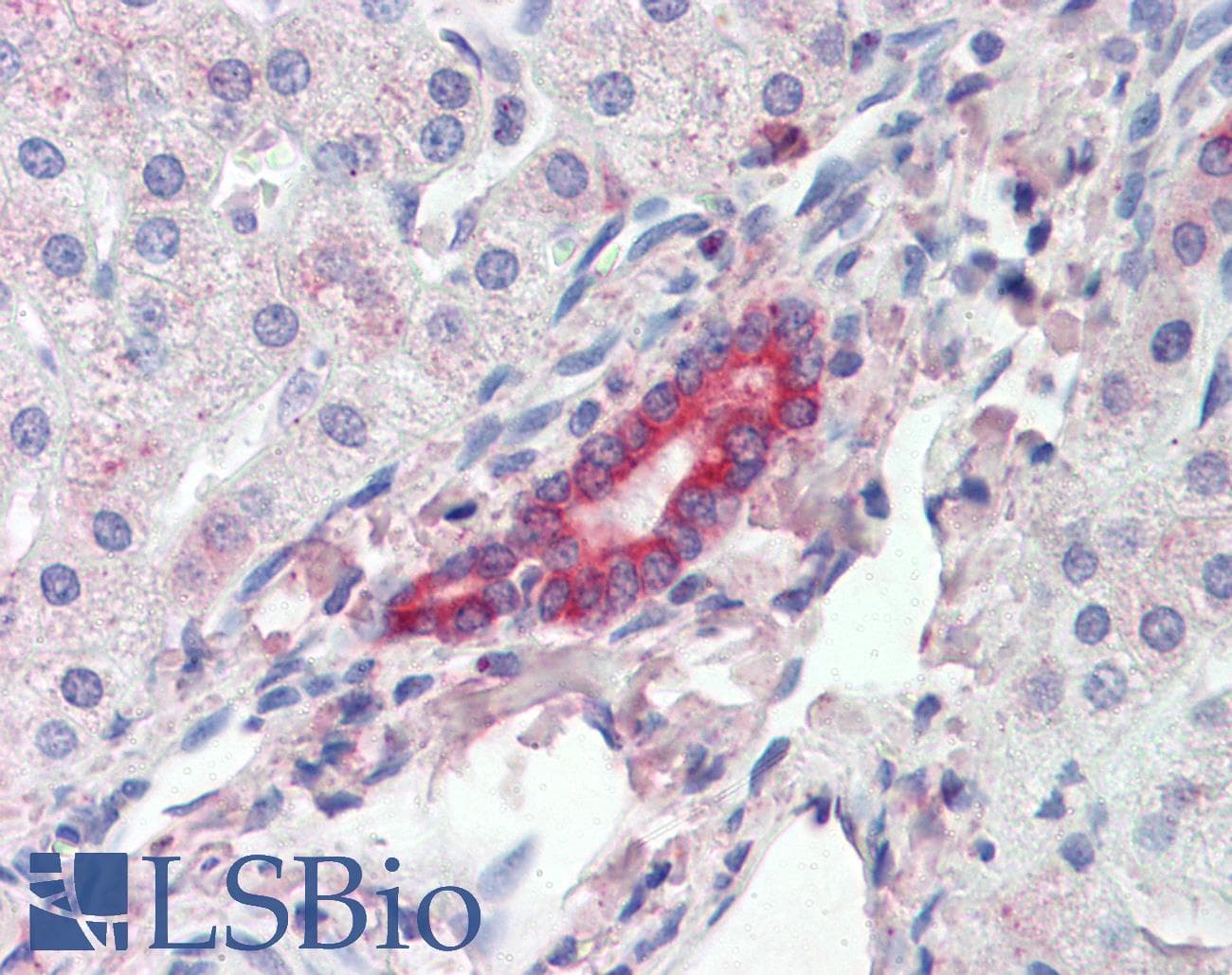PathPlus™ Polyclonal Goat anti-Human ROR1 Antibody (IHC)