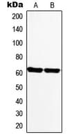 MAOA / Monoamine Oxidase Antibody (Internal)