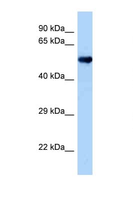 Polyclonal Rabbit anti-Mouse OXSR1 / OSR1 Antibody (aa307-356, WB)