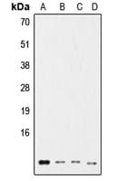 Polyclonal Rabbit anti-Human Ubiquitin Antibody (Internal, IHC, WB)