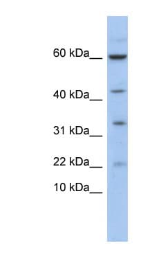 Polyclonal Rabbit anti-Human LMO2 Antibody (aa35-84, WB)