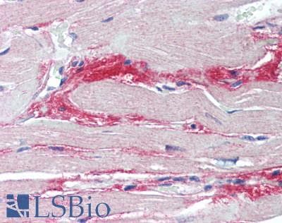 IHC-plus™ Polyclonal Rabbit anti-Human Collagen XII Alpha 1 Antibody (aa140-316, IHC)