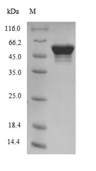 Mouse ATP5B / ATP Synthase Beta Protein (Recombinant 10His-SUMO, N-terminus + Myc, C-terminus)