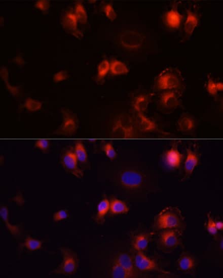 Polyclonal Rabbit anti-Human EGFR Antibody (IHC, IF, WB)