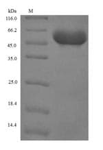 Human SFTPC / Surfactant Protein C (Recombinant GST, N-terminus)