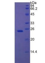 Rat IGFBP7 / TAF Protein (Recombinant His-T7)