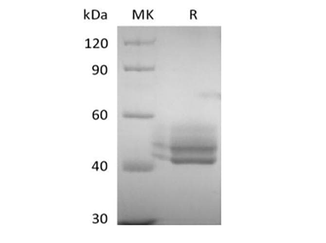 Human CD3E Protein (Recombinant Fc/6His,C-terminus)