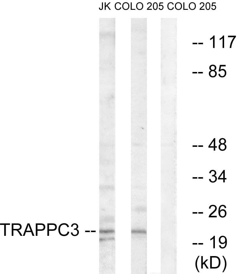 TRAPPC3 Antibody (aa131-180)