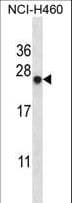 BAG2 Antibody (aa148-176)