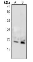 Polyclonal Rabbit anti-Human MBP / Maltose Binding Protein Antibody (WB)