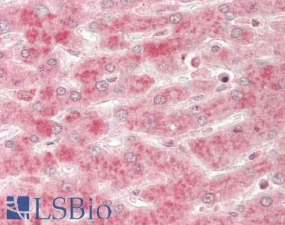 IHC-plus™ TNFRSF10B / Killer / DR5 Antibody (clone HS201)
