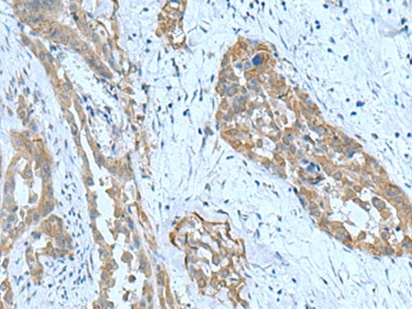 SRPK2 Antibody