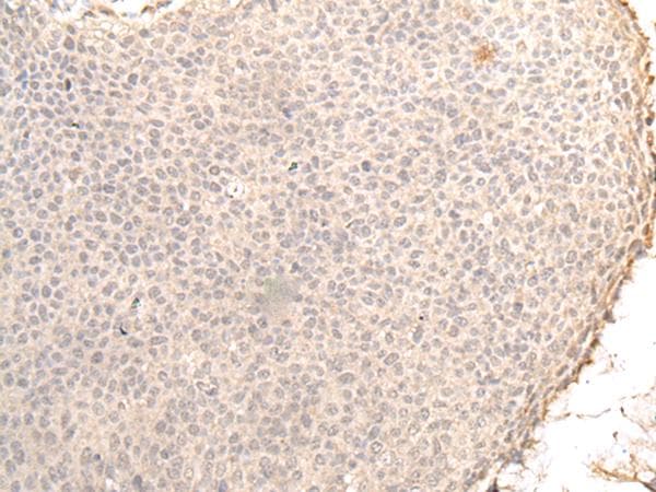 ZNF263 Antibody