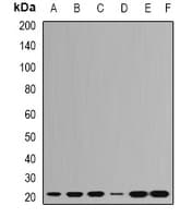 RPL9 / Ribosomal Protein L9 Antibody