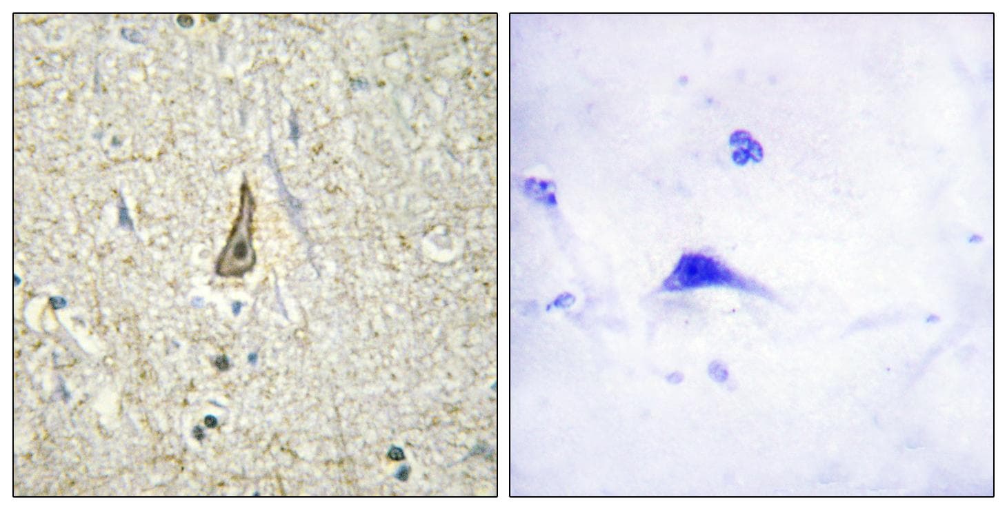 Polyclonal Rabbit anti-Human CYP26C1 Antibody (IHC)