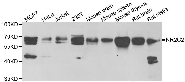 Polyclonal Rabbit anti-Human NR2C2 / TAK1 Antibody (IHC, WB)